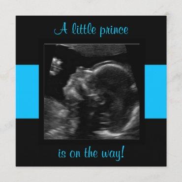 Boy Baby Customized Ultrasound Photo Template