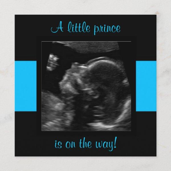 Boy Baby Customized Ultrasound Photo Template
