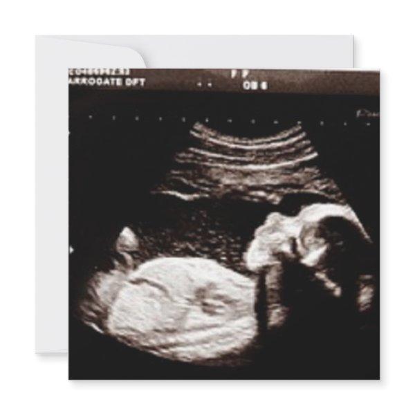 Personalized Ultrasound Picture Baby Shower