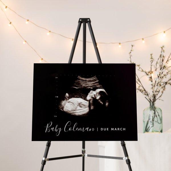 Pregnancy Announcement Baby Shower Sonogram Sign