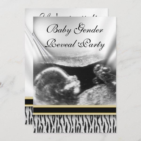 Ultrasound Baby Gender Reveal Party