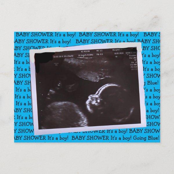 Ultrasound Picture  Postcard